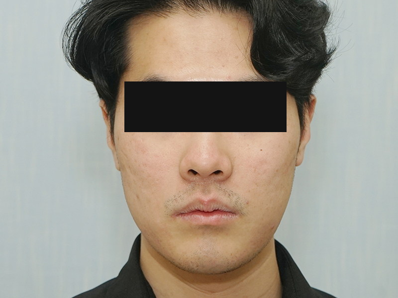 후사진